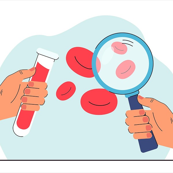 آزمایش بررسی کم خونی